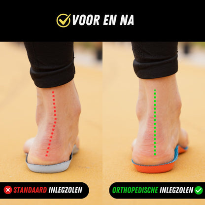 👣 Orthopedic Arch Support Insoles – All-Day Comfort for Tired, Aching Feet